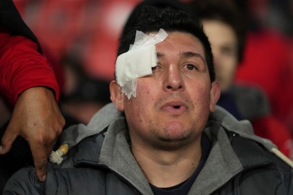 Las secuelas del horror: un herido grave y 18 chilenos afectados tras la barbarie