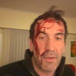 Asaltaron y golpearon al candidato a senador Pablo Cervi: “Le gatillaron varias veces”