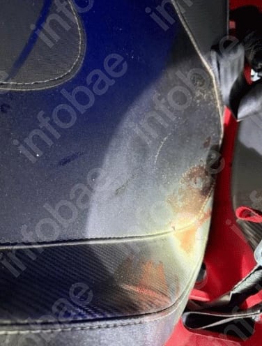 Uno de los asiento del UTV con sangre 