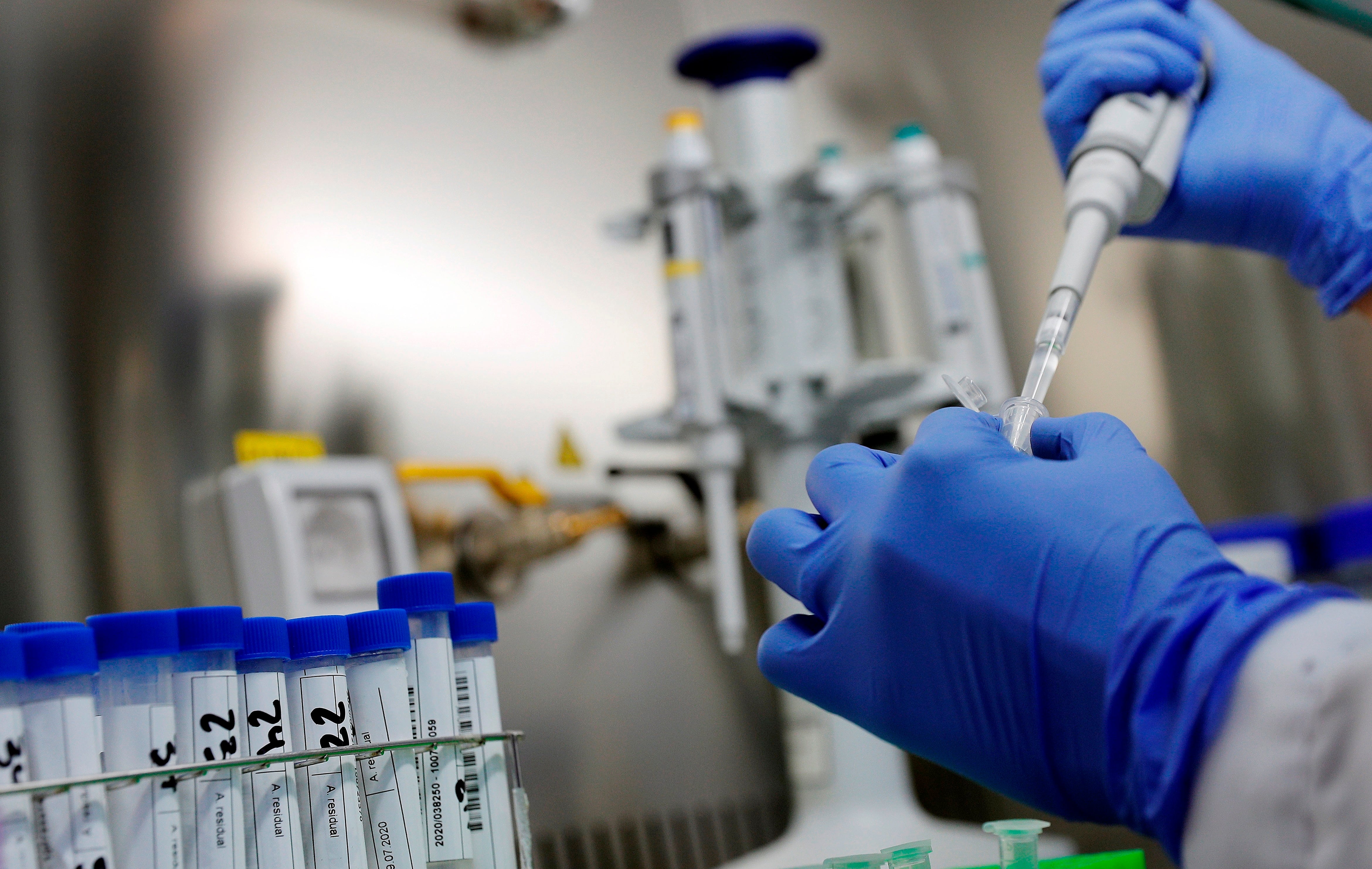 India confirmó dos casos de Nipah en Bengala Occidental desde diciembre, implementó aislamiento y rastreo de 196 contactos, todos sometidos a pruebas diagnósticas y cuarentena, resultando negativos y evitando, hasta el momento, la propagación fuera del país /EFE/Kai Försterling/Archivo 