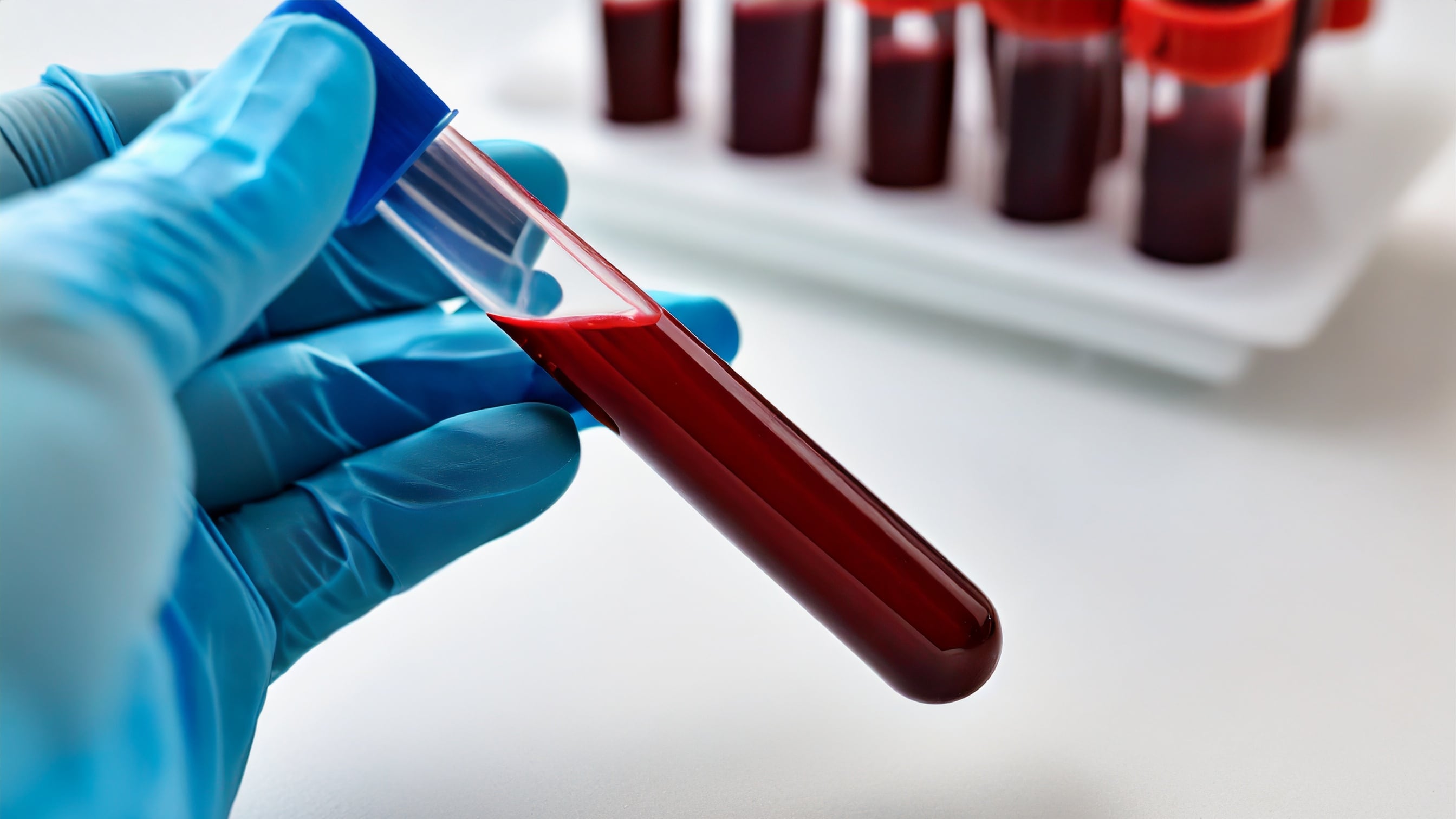 Pacientes con niveles bajos o indetectables de ctDNA antes del tratamiento mostraron mejores respuestas terapéuticas y prolongaron el tiempo sin progresión (Imagen Ilustrativa Infobae)
