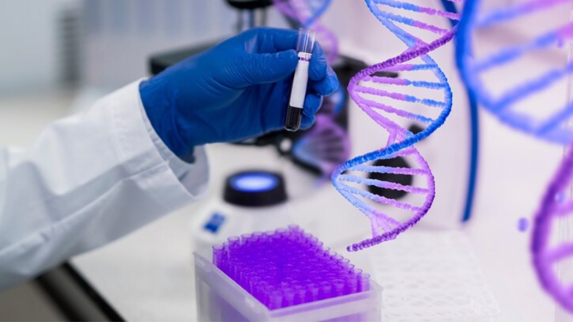 Un estudio en el Reino Unido identificó 71 variantes asociadas a la manía, el componente esencial del trastorno bipolar (Freepik)