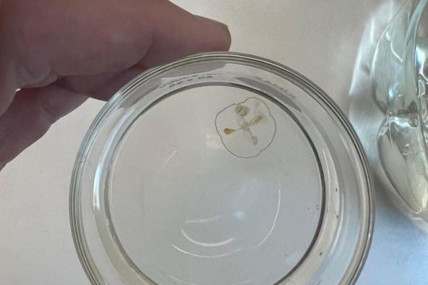 Detectaron medusas invasoras de agua dulce en lagos de Bariloche y encendieron una alerta ambiental