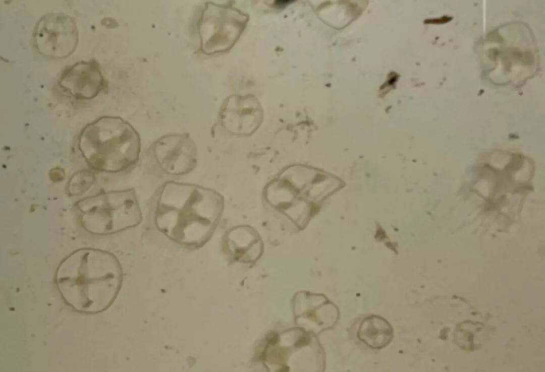 Investigadoras del INIBIOMA y la UNCo detectaron por primera vez medusas exóticas de agua dulce en los lagos Escondido y El Trébol, cerca de Bariloche