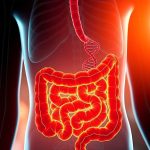 El cáncer de colon ahora es la principal causa de muerte por cáncer para los estadounidenses menores de 50 años, según un estudio