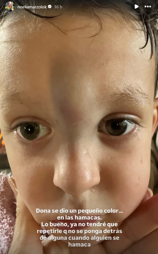 En septiembre pasado, Donatello se golpeó con las hamacas de una plaza (Instagram)