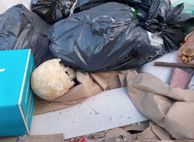 El hueso encontrado en la basura (Foto: La Capital)