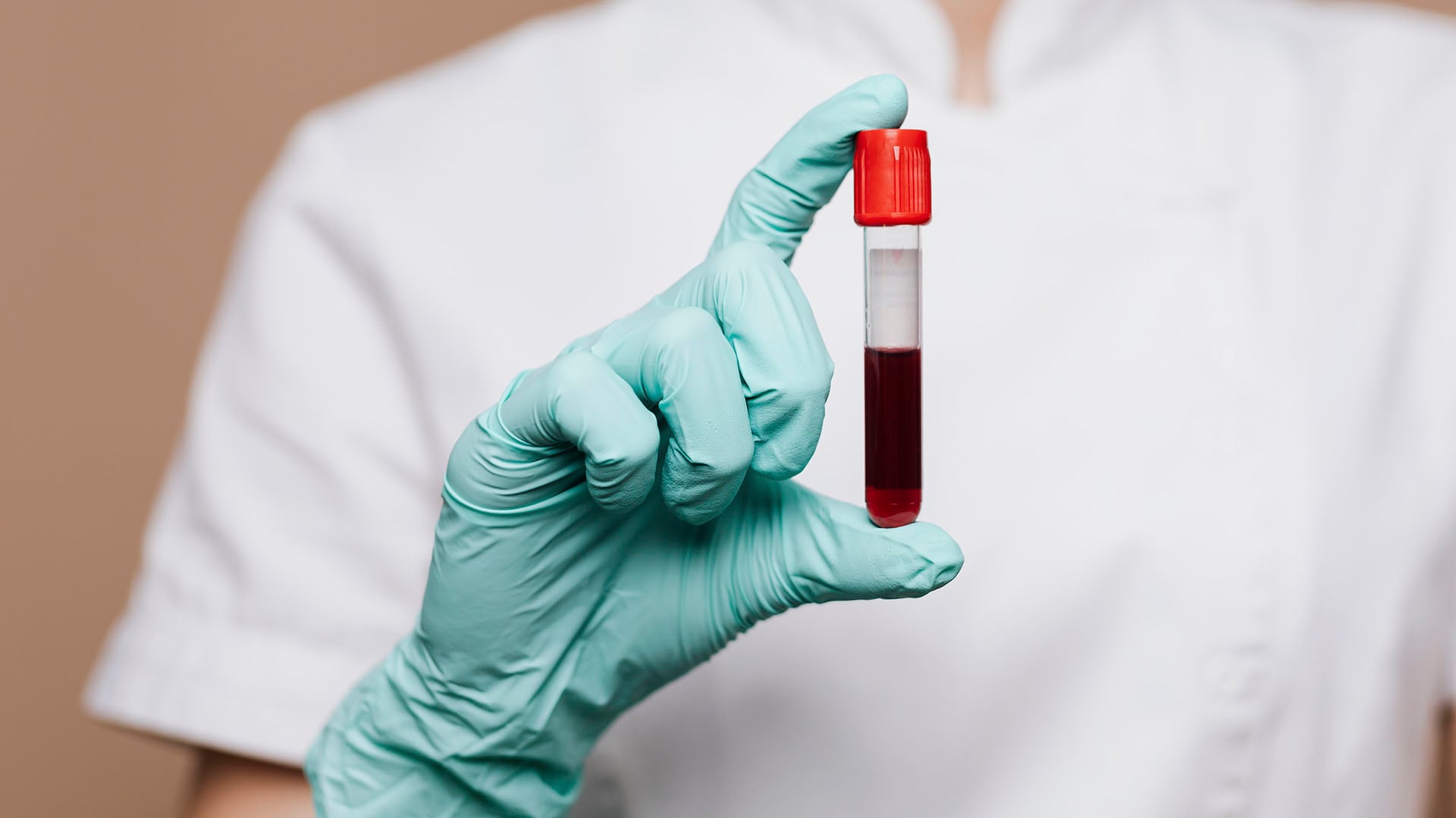 El diagnóstico del hantavirus se confirma mediante estudios de laboratorio que detectan resultados positivos o reactivos en muestras de pacientes con sospecha clínica (Freepik)