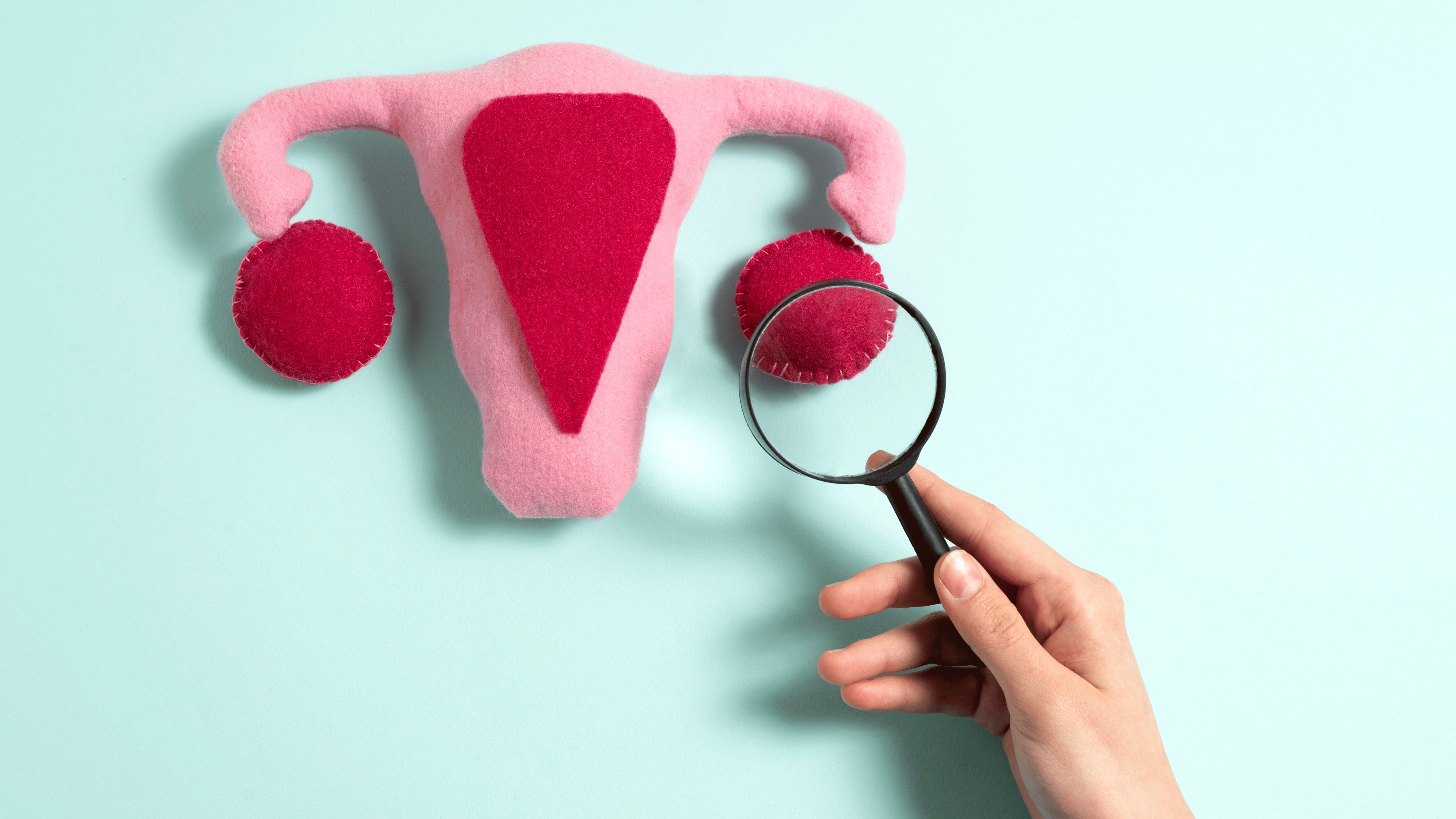 La endometriosis se caracteriza por el crecimiento de tejido similar al endometrio fuera del útero, con localizaciones frecuentes en ovarios, trompas de Falopio, intestino, vejiga y diafragma (Freepik)