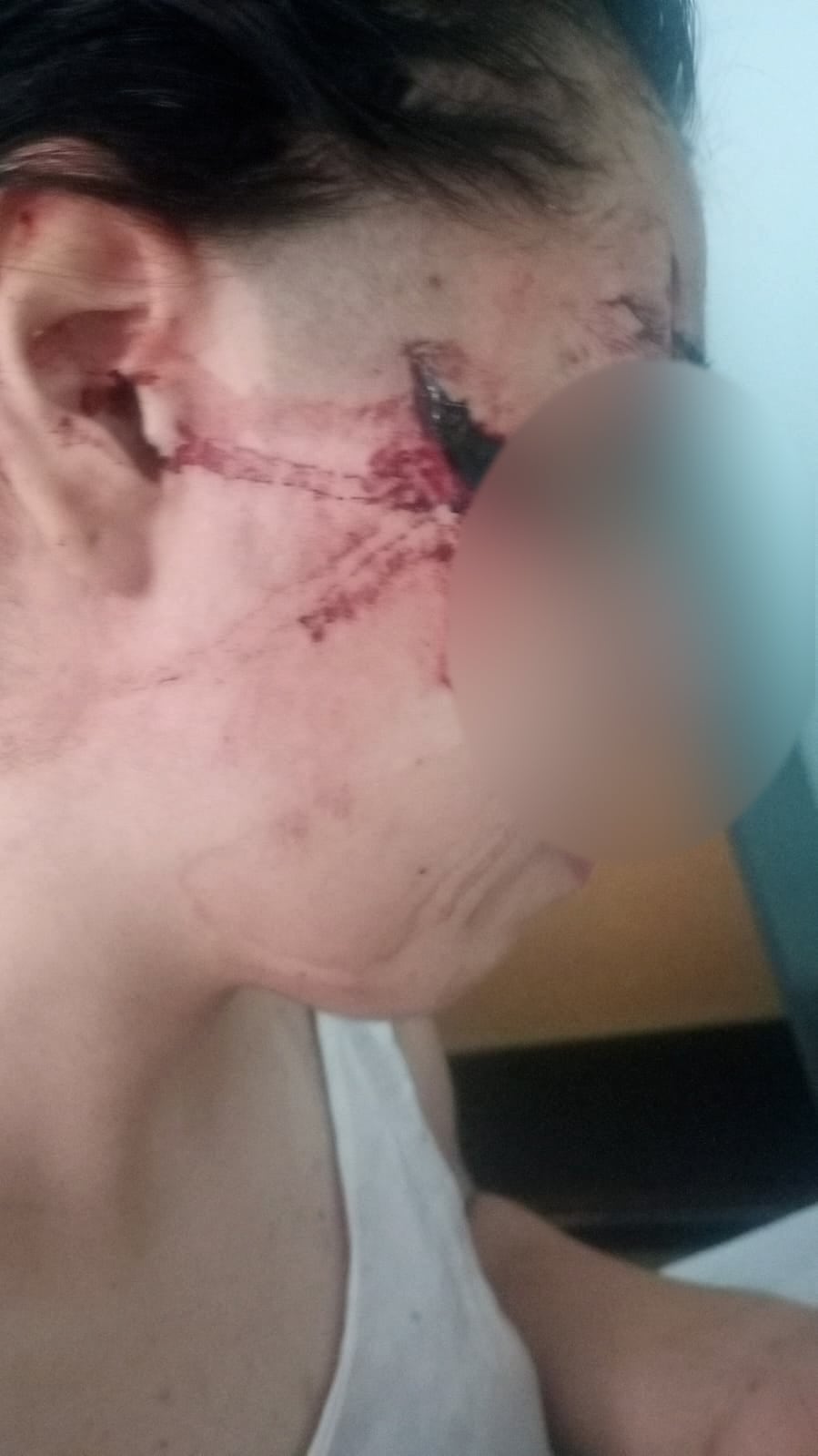 La madre de Delfina denunció que su hija es víctima de un bullying sistemático por parte de sus agresores. (Gentileza: San Cristóbal al Día)