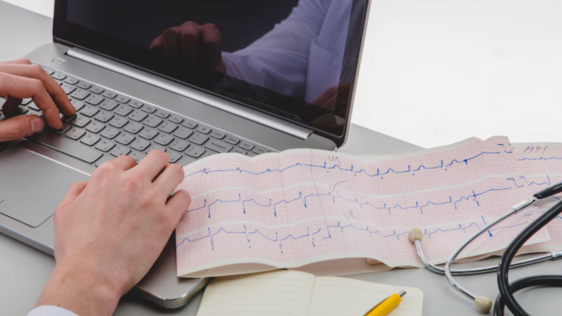 La cantidad o intensidad del ejercicio no influye en el riesgo: la presencia de fibrosis es el principal factor asociado a arritmias en adultos mayores. (Imagen Ilustrativa Infobae)