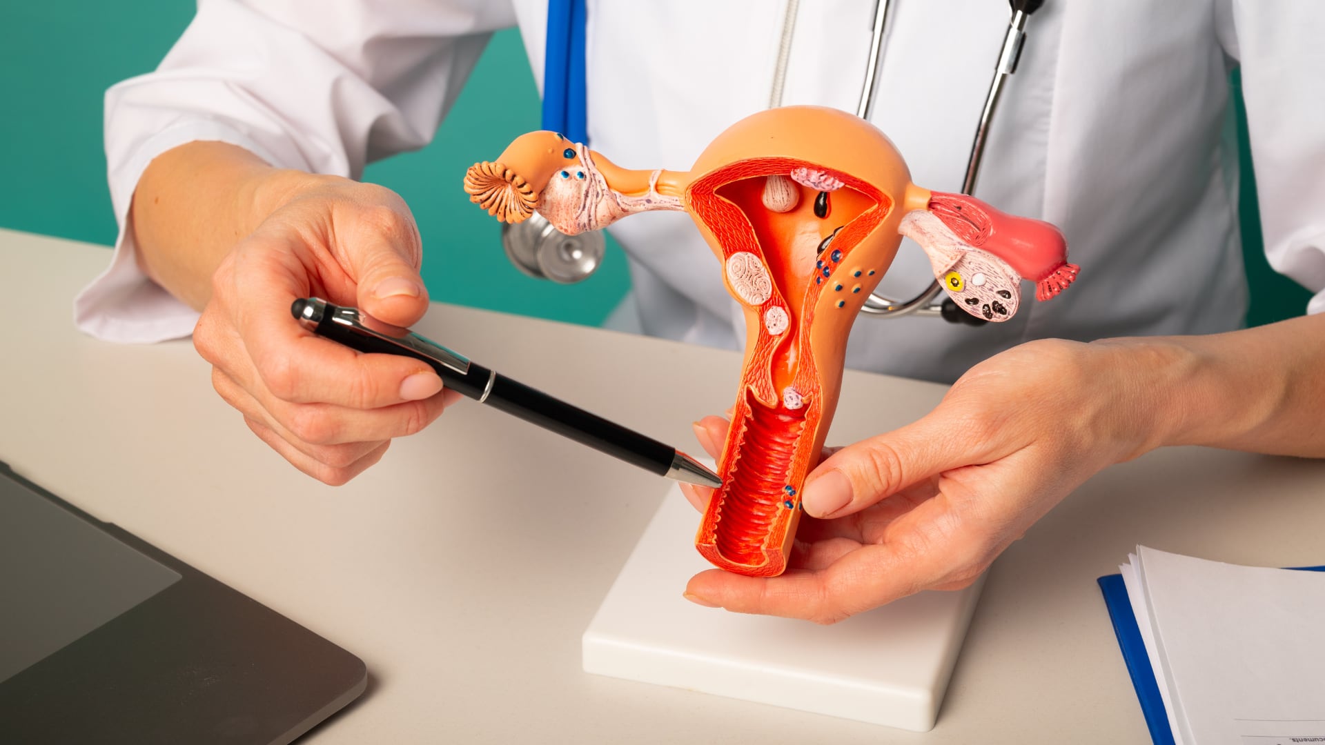 Pólipos y fibromas uterinos figuran entre las causas benignas más frecuentes de sangrado después de la menopausia, junto con la atrofia vaginal (Canva)