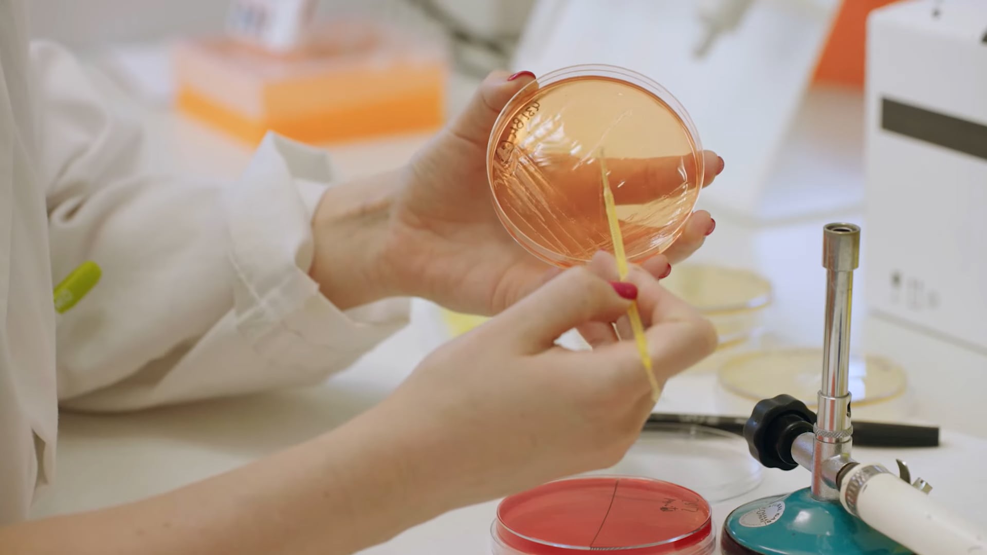 El equipo analizó muestras de sangre y heces de pacientes y convivientes. Usó pruebas genéticas y cultivos para detectar producción de etanol y cambios en la microbiota (Archivo EFE)