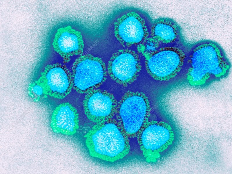 Imagen microscópica colorizada del virus de la influenza A (H3N2), subclado K, identificado como el principal responsable del incremento de contagios (AP)