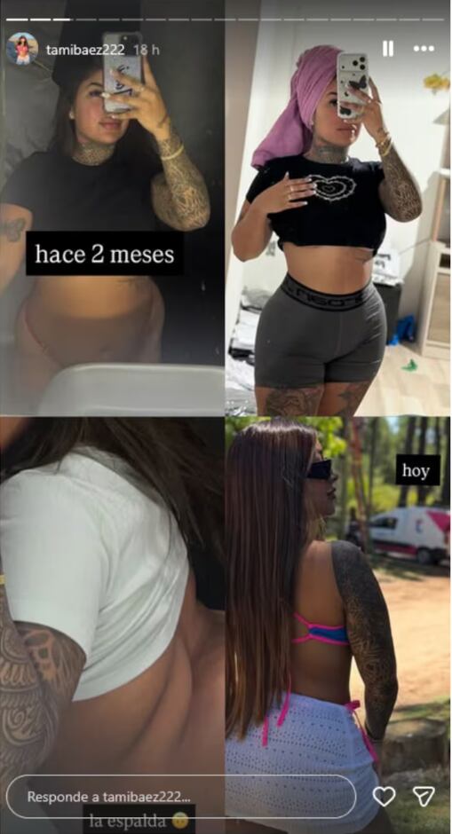 Tamara compartió una serie de imágenes para comparar el resultado de su retoque estético