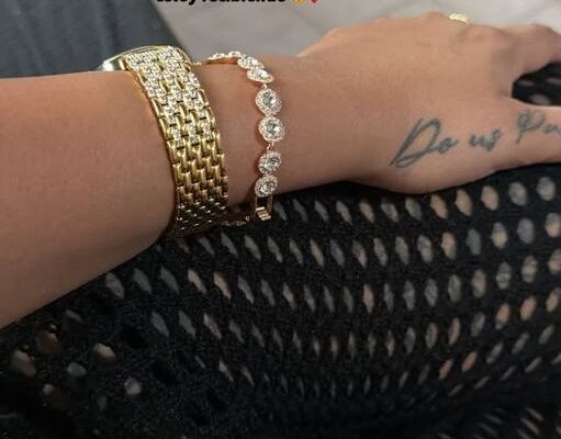 Tamara Báez mostró el antes y después de su retoque estético ante las críticas de sus seguidores