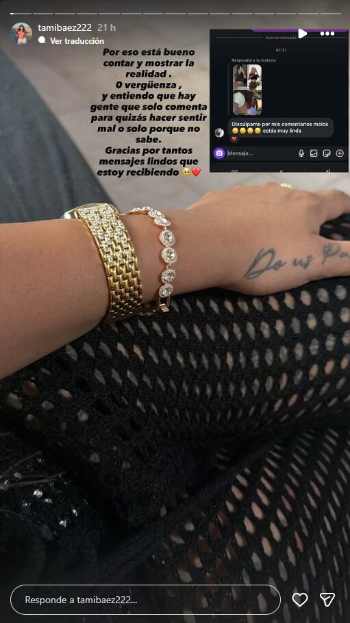 Tamara Báez mostró el antes y después de su retoque estético ante las críticas de sus seguidores