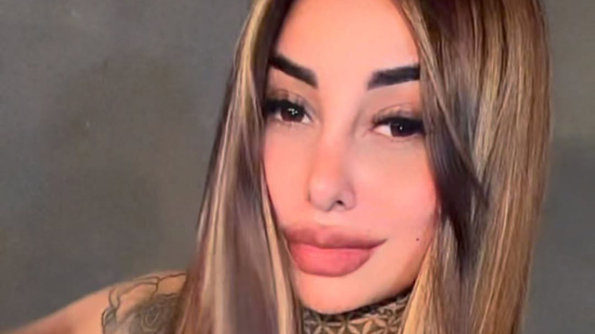 Tamara Báez decidió compartir el antes y después de su cirugía ante los comentarios negativos en las redes (Instagram)