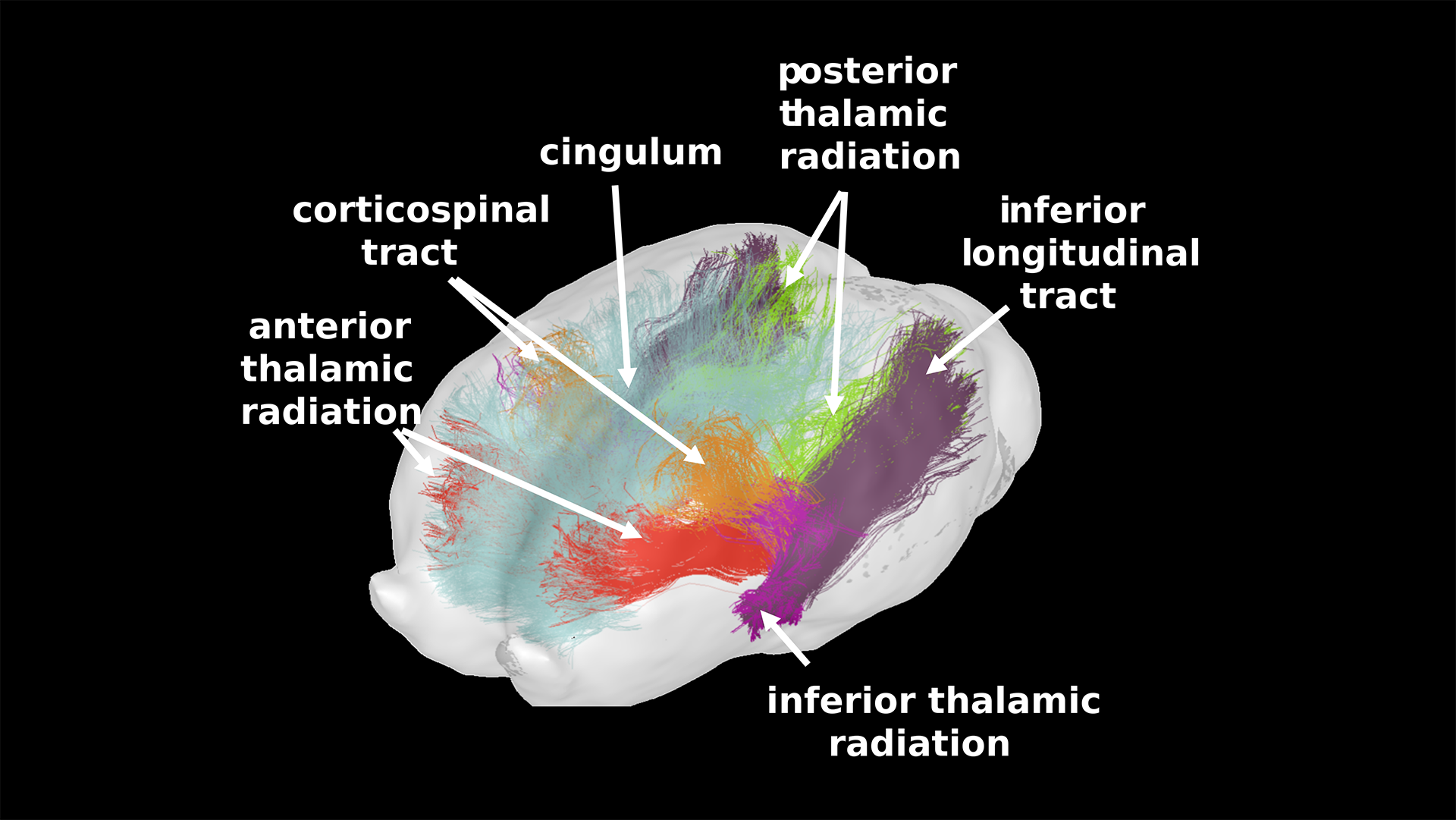 Se observó un aumento en la materia gris de las regiones cerebrales asociadas a la sociabilidad en caballos beneficiados por el vínculo materno (UMR PRC INRAE-CNRS-Université de Tours. M.E. Le Bachelier de la Rivière)