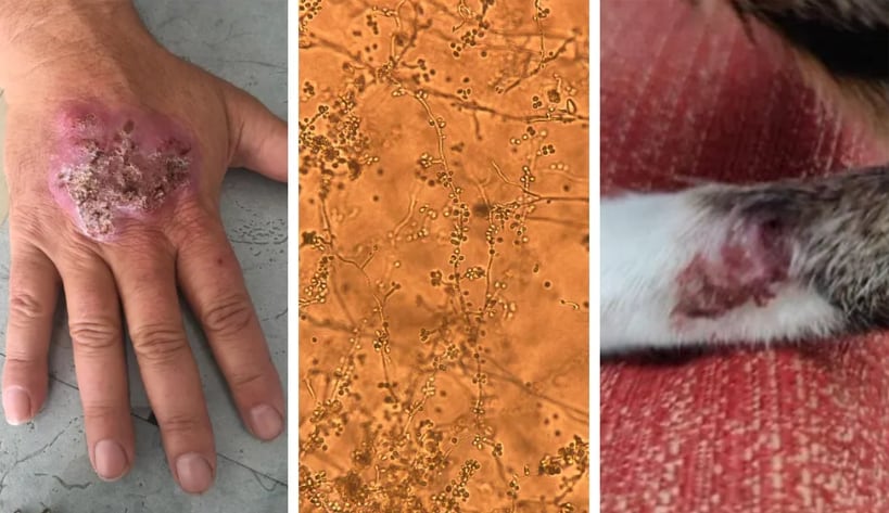 El brote detectado en Maldonado y Rocha marca la primera vez que se confirma la circulación local de Sporothrix brasiliensis en Uruguay, según expertos 