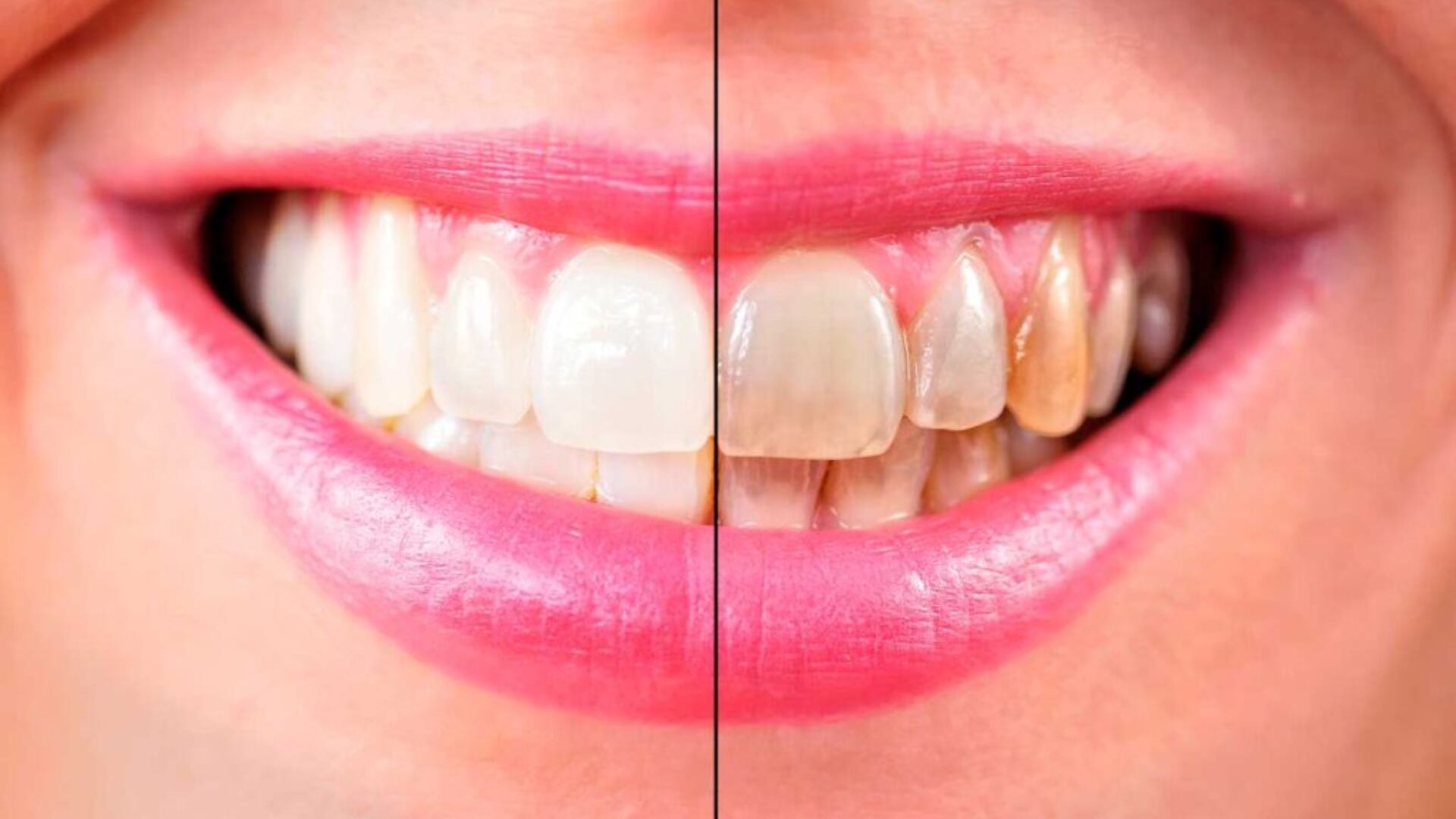 nsumir alimentos ácidos, como jugos de cítricos y gaseosas azucaradas, acelera el deterioro del esmalte dental y potencia la sensibilidad (Foto: UNAM Global Revista)