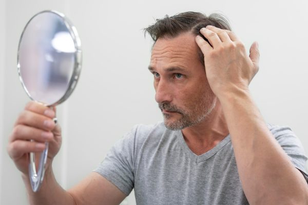 Células madre para la caída del cabello: qué dice la ciencia sobre su efectividad