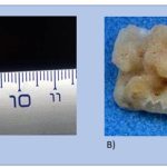 Descubrieron en Grecia un cráneo humano de casi 300.000 años que no es Homo sapiens ni neandertal