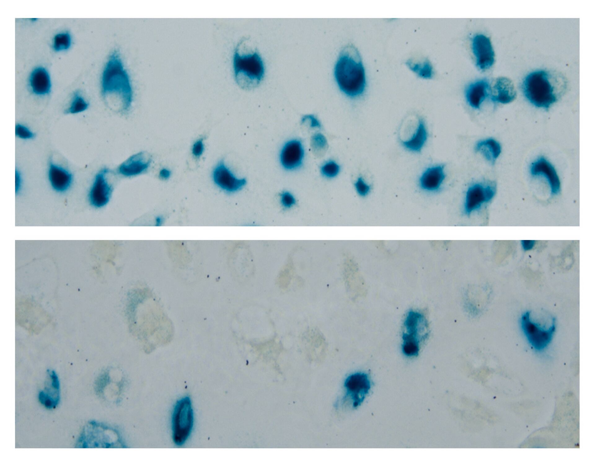 Las terapias dirigidas y la inmunoterapia cambiaron el pronóstico incluso en cánceres avanzados antes considerados intratables (AP) 