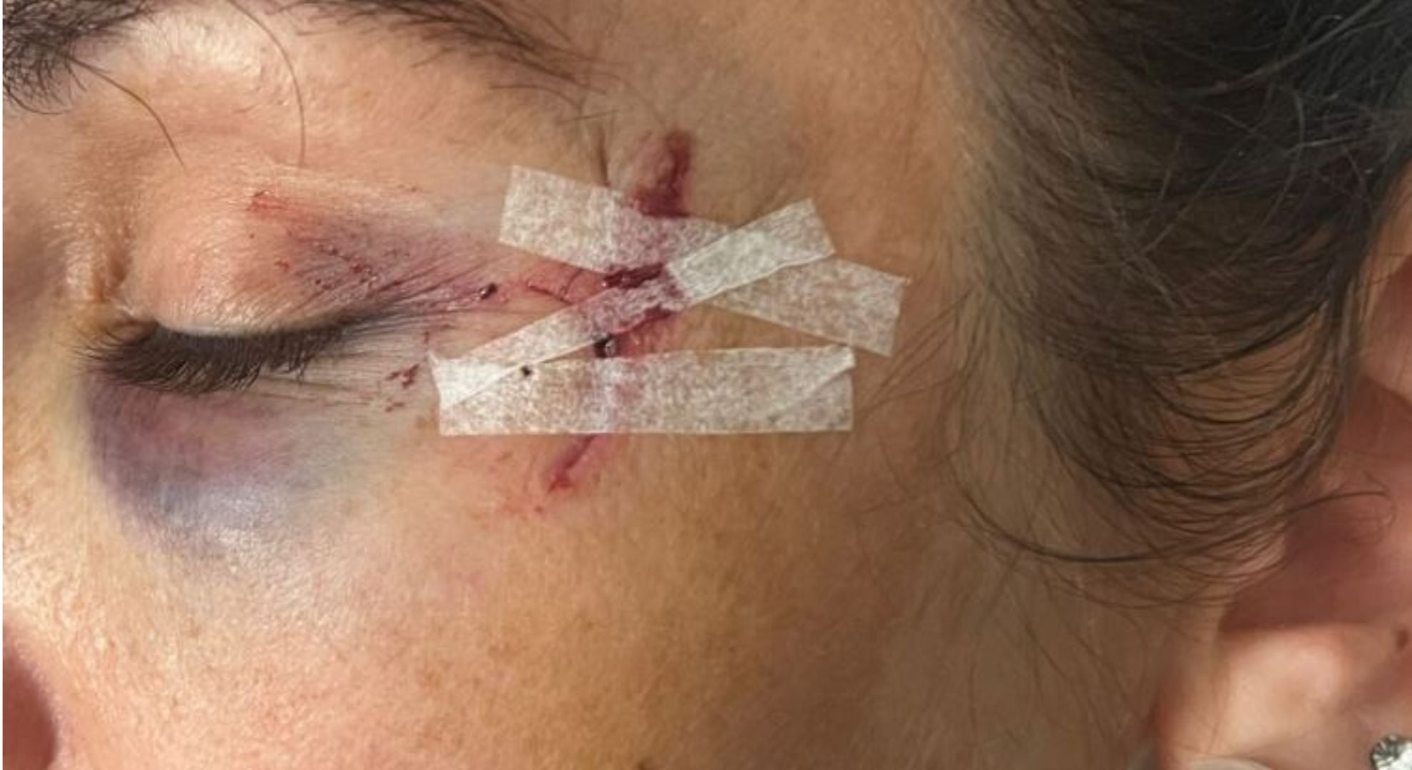 Así quedó el rostro de la mujer, tras las agresiones (Gentileza: LT9)