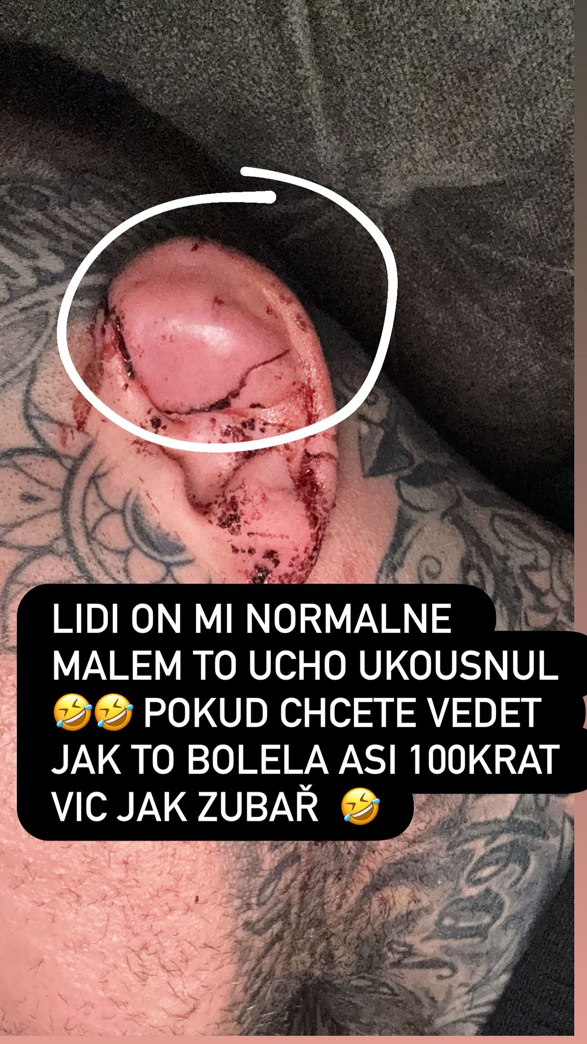 Un luchador de MMA le mordió la oreja a su rival en pleno combate