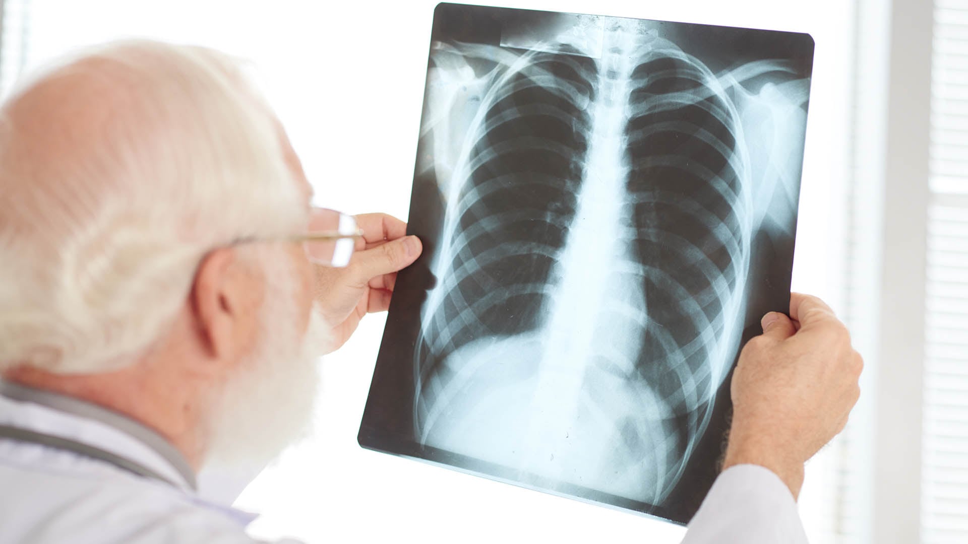 El Ministerio de Salud advierte que la protección solo se logra con esquemas de vacunación completos en todas las etapas recomendadas 