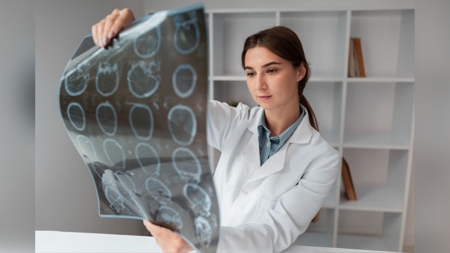 Qué es un ACV hemorrágico, como el que sufrió Daniela Ballester