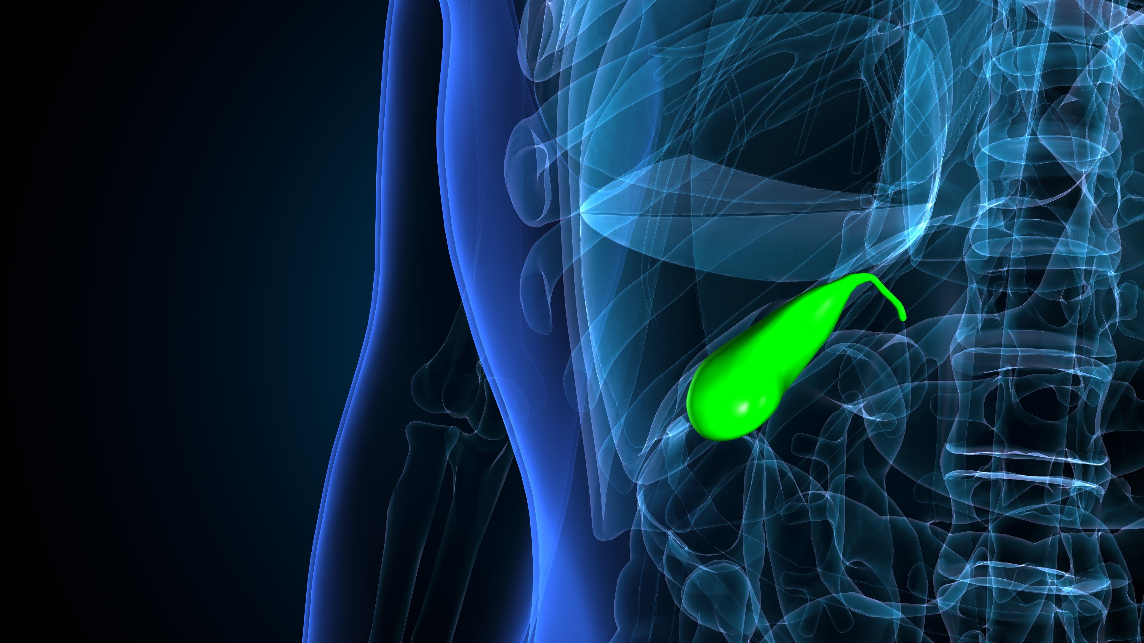 La formación de lodo biliar y cálculos en la vesícula puede bloquear conductos biliares y causar cólico biliar e inflamación (Créditos: Freepik)