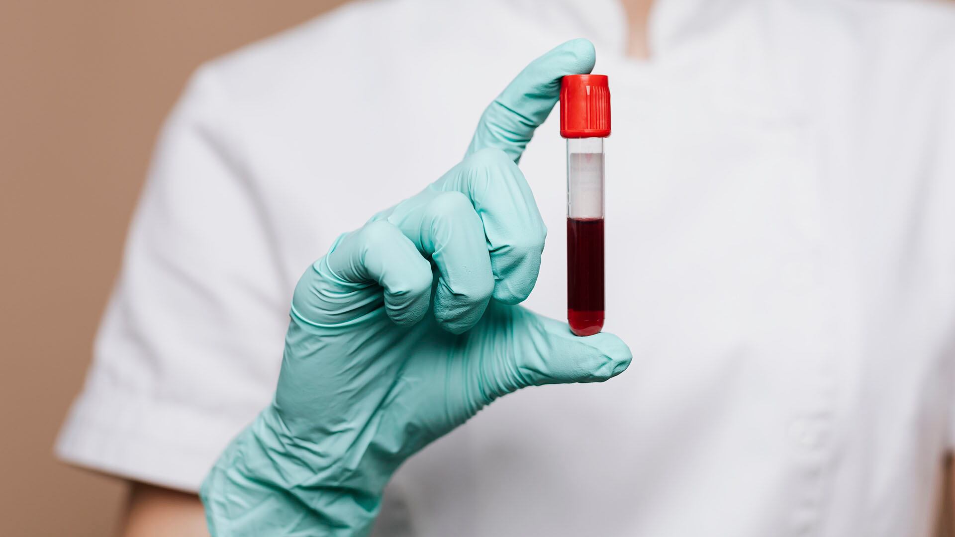 La sangre solo puede conservarse por un tiempo limitado: una vez vencido ese plazo, los componentes dejan de ser utilizables. Freepik)