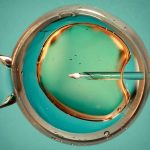 Una opción ‘natural’ para la FIV es igual de eficaz para producir bebés sanos, según demuestra el ensayo