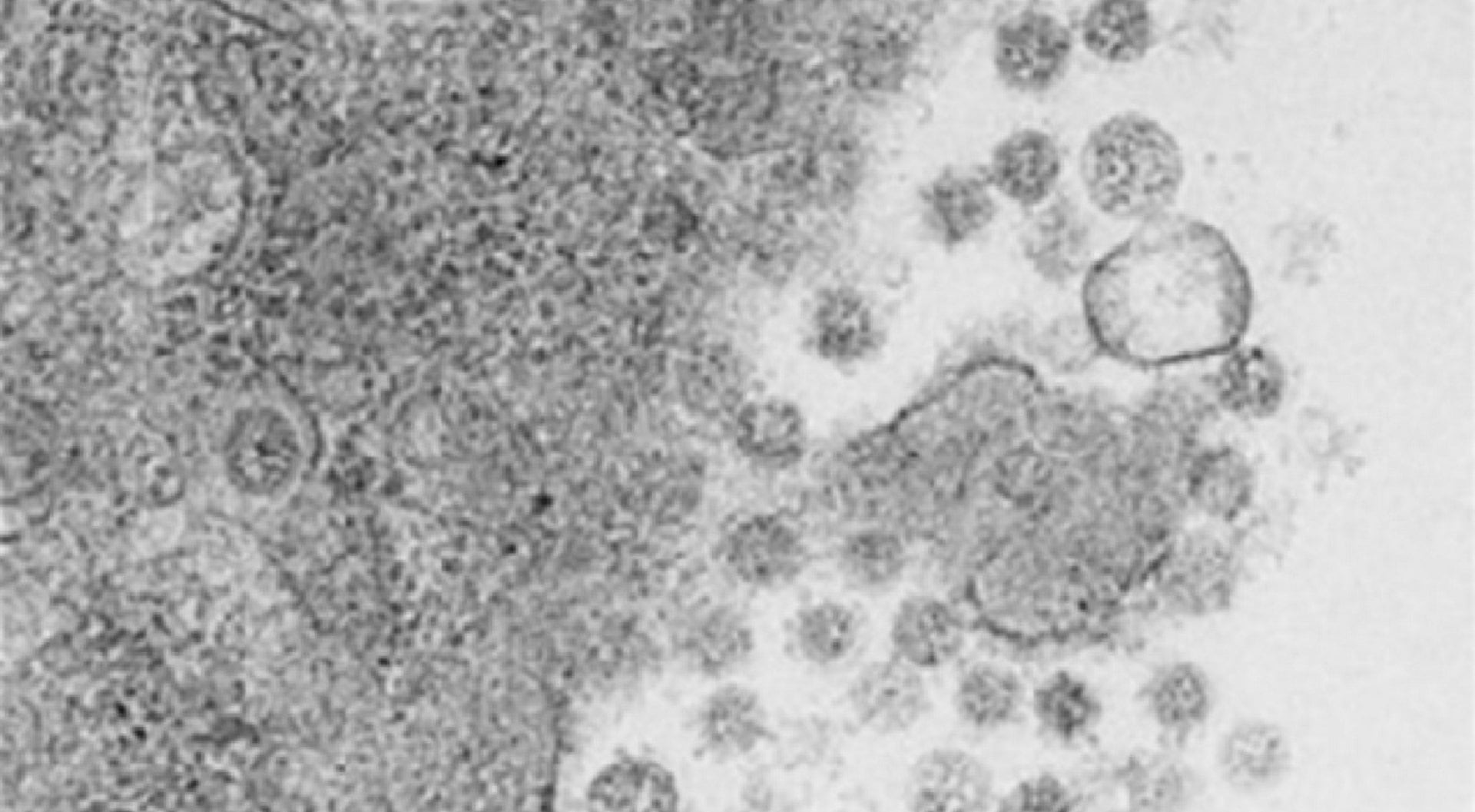 Virus del SARS-CoV-2 saliendo de las células infectadas . -
CSIC/EQUIPO DE LUIS ENJUANES_PNAS