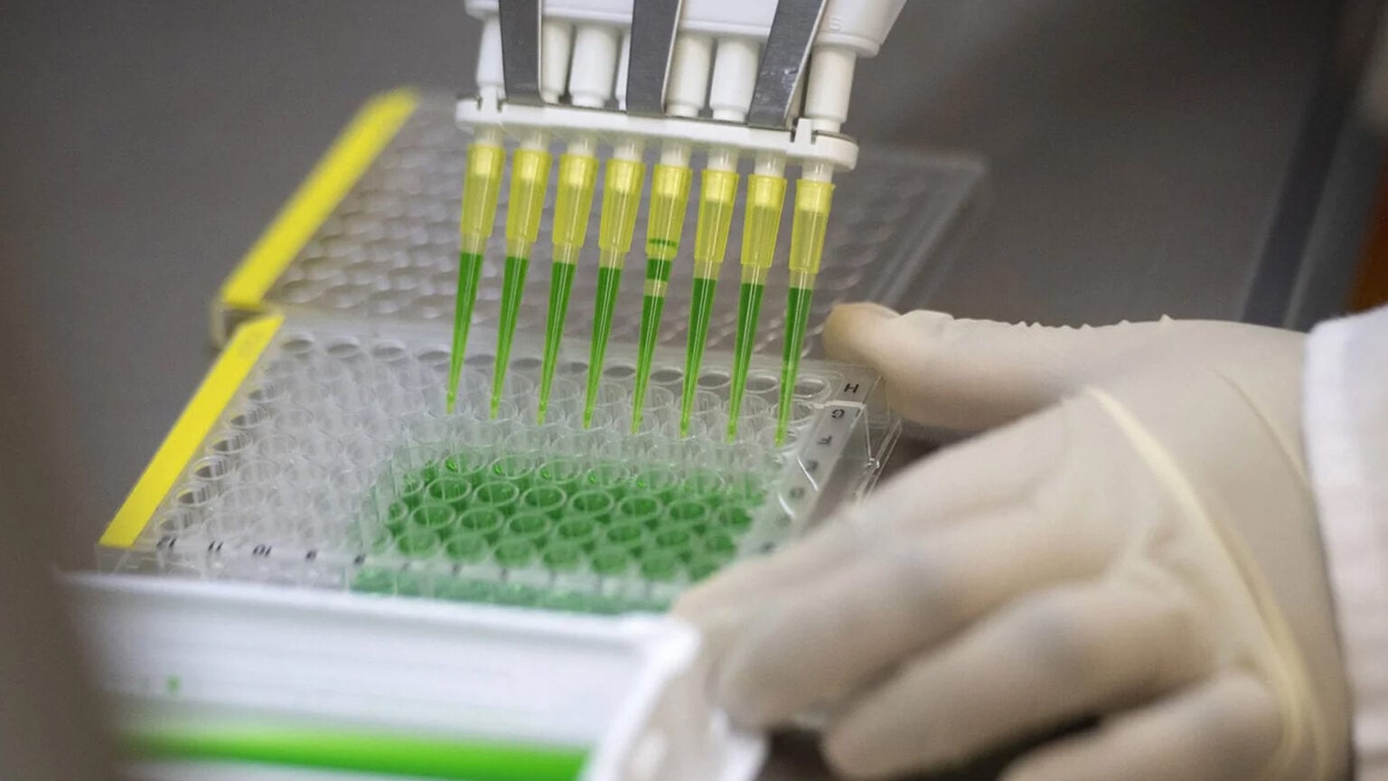 La alianza de fabricación fortalecerá la capacidad en la región, impulsando un suministro regional sostenible, confiable y escalable para los países miembros de OPS 