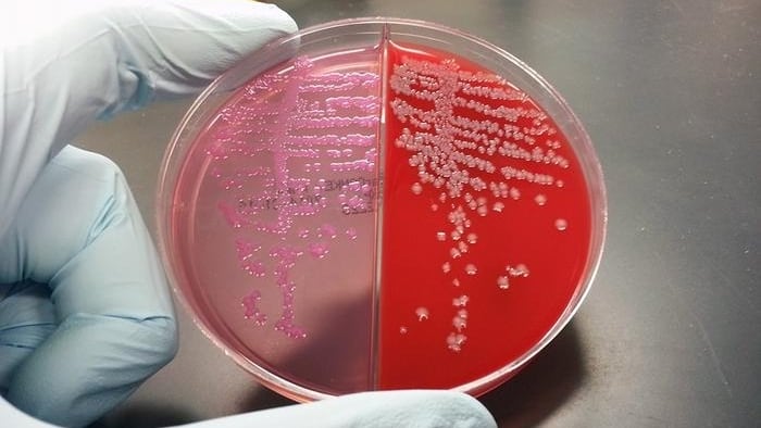 El análisis del microbioma canino utilizó secuenciación del gen 16S rRNA y detectó 899 variantes bacterianas en 51 perros./Archivo Sokurenko Lab/UW Medicine