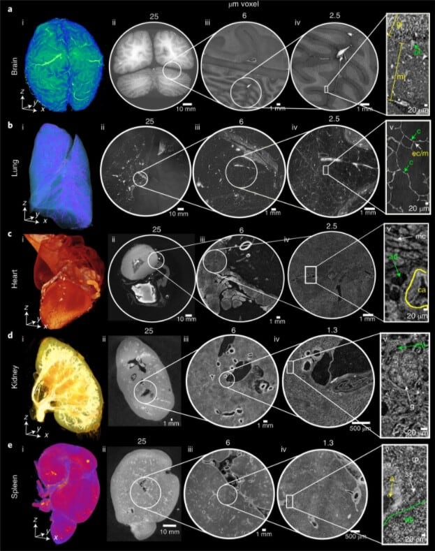 El portal ofrece imágenes de 65 órganos de 13 tipos diferentes, procedentes de 32 donantes y cientos de conjuntos de datos tridimensionales (HOA) 