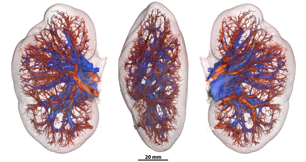El proyecto busca impulsar la ciencia abierta y la colaboración global, facilitando el acceso a la anatomía humana a investigadores y estudiantes (HOA) 