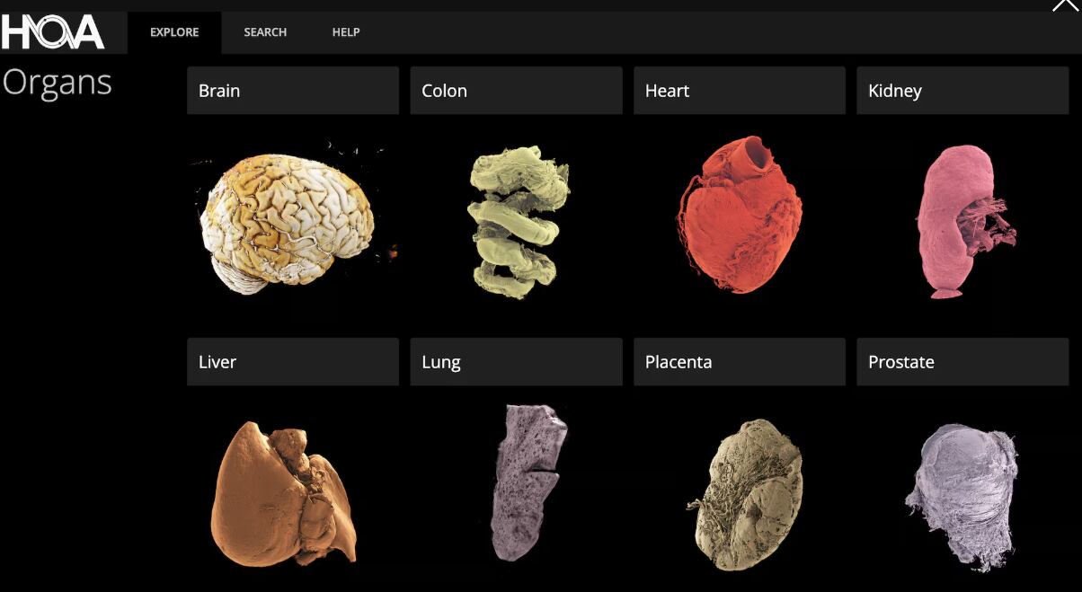 El Atlas de Órganos Humanos permite explorar en 3D cerebros, pulmones, riñones y otros órganos completos con resolución sin precedentes, acceso libre (HOA) 