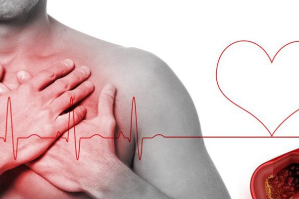 Cuál es el valor normal de colesterol LDL, según las nuevas guías de valores sugeridos