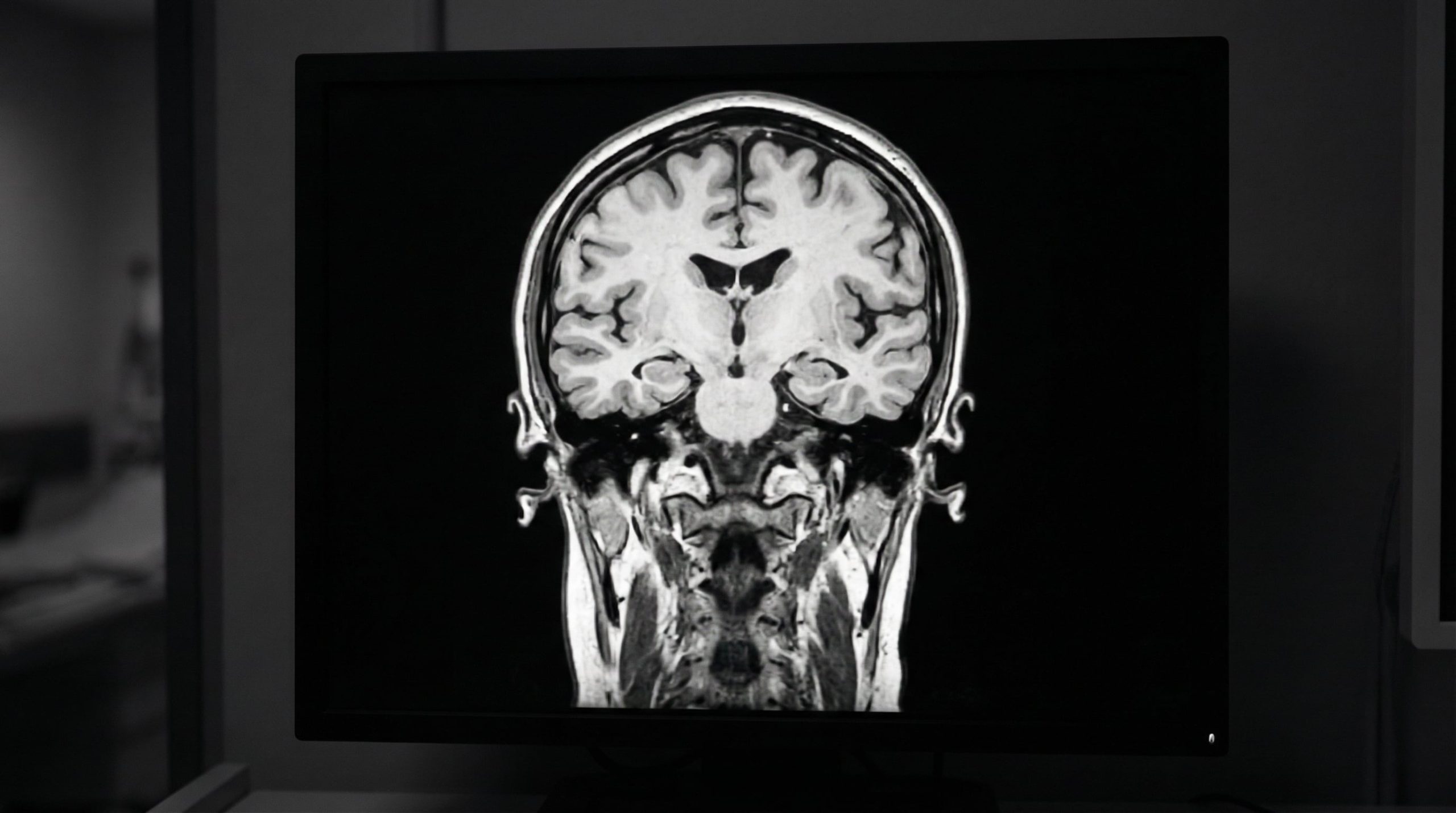 Cuáles son los 7 síntomas que anticipan enfermedades relacionadas con la memoria