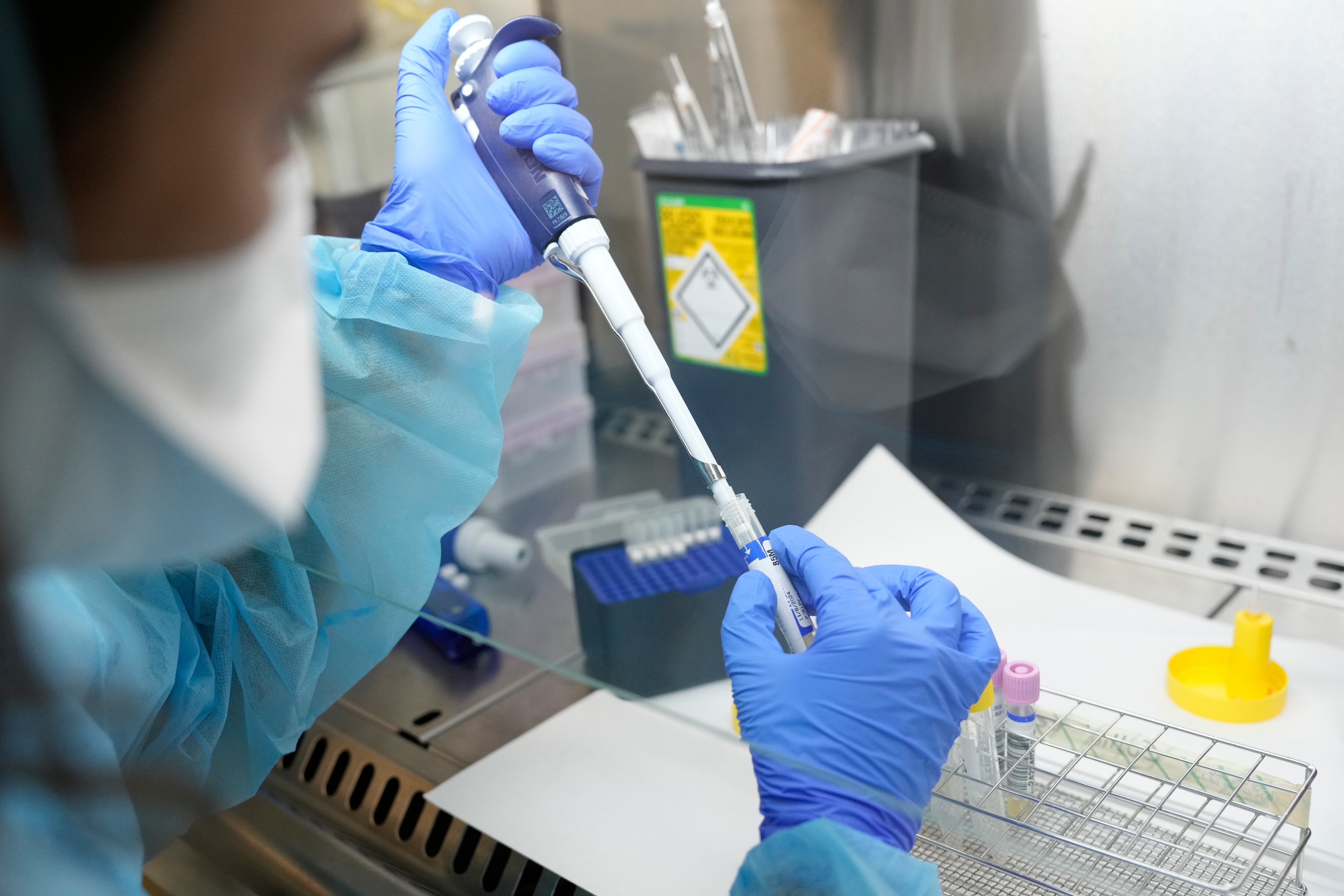 Un diagnóstico temprano y el acompañamiento médico son fundamentales para el manejo de la enfermedad y la reducción de riesgos.
- EFE/ Alejandro García 