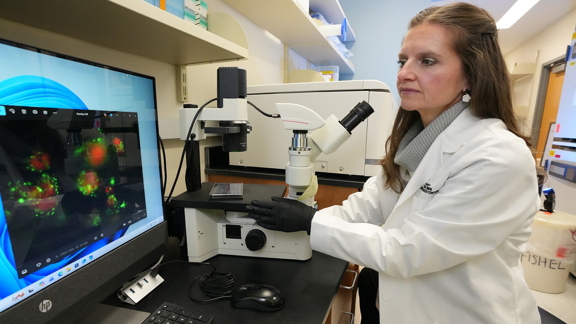 Un equipo de científicos, liderado por Melissa Fishel, descubrió en los Estados Unidos que reducir el fibrinógeno puede frenar el avance del cáncer de páncreas y su metástasis en el hígado (Tim Yates, IU School of Medicine)