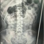 Dos personas dejaron dos mochilas con más de 25 kilos de cocaína y escaparon en Tucumán: la droga fue incautada por la policía