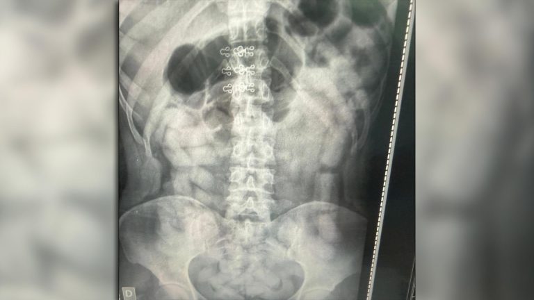 Dos personas dejaron dos mochilas con más de 25 kilos de cocaína y escaparon en Tucumán: la droga fue incautada por la policía