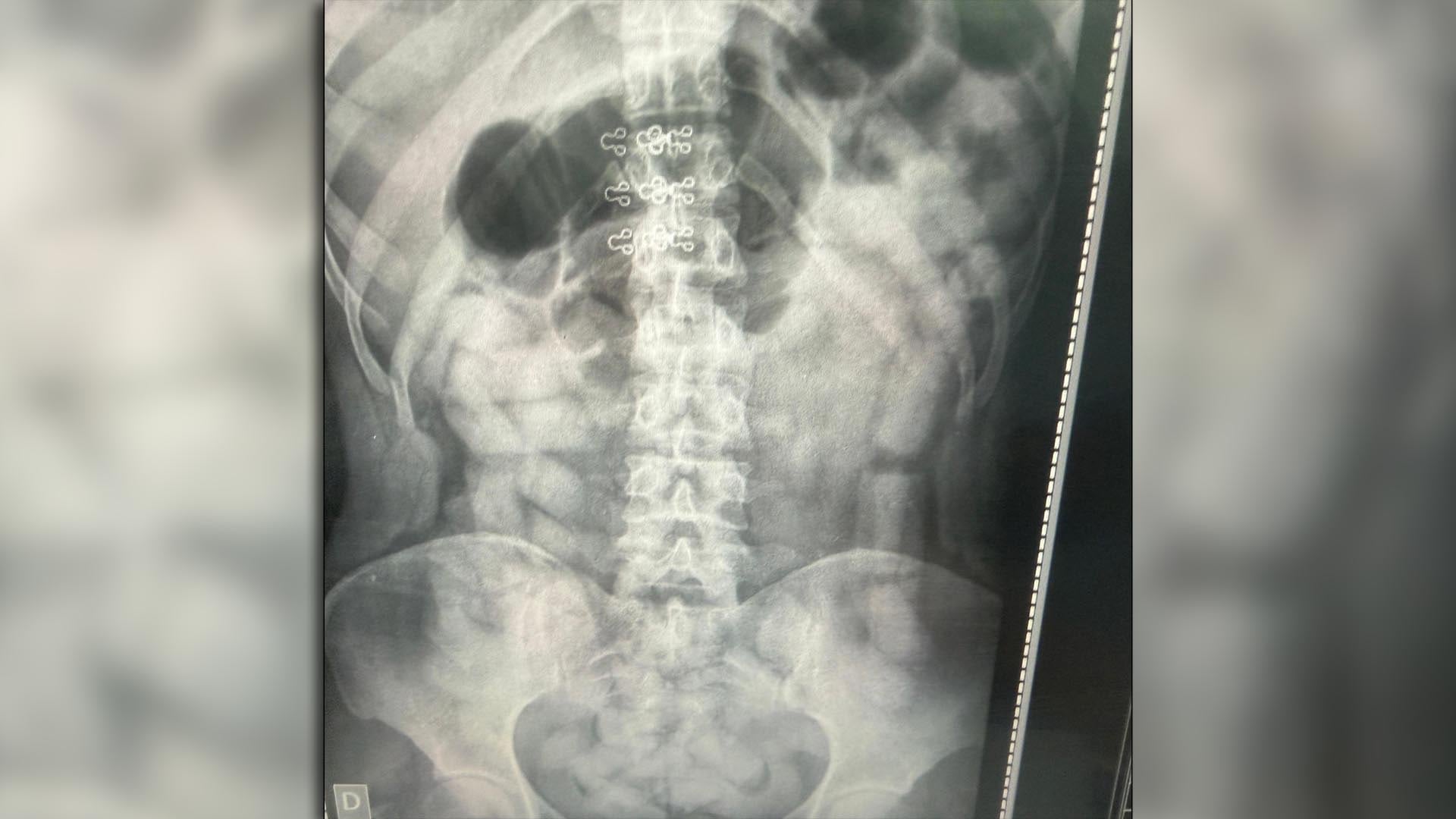 Dos personas dejaron dos mochilas con más de 25 kilos de cocaína y escaparon en Tucumán: la droga fue incautada por la policía