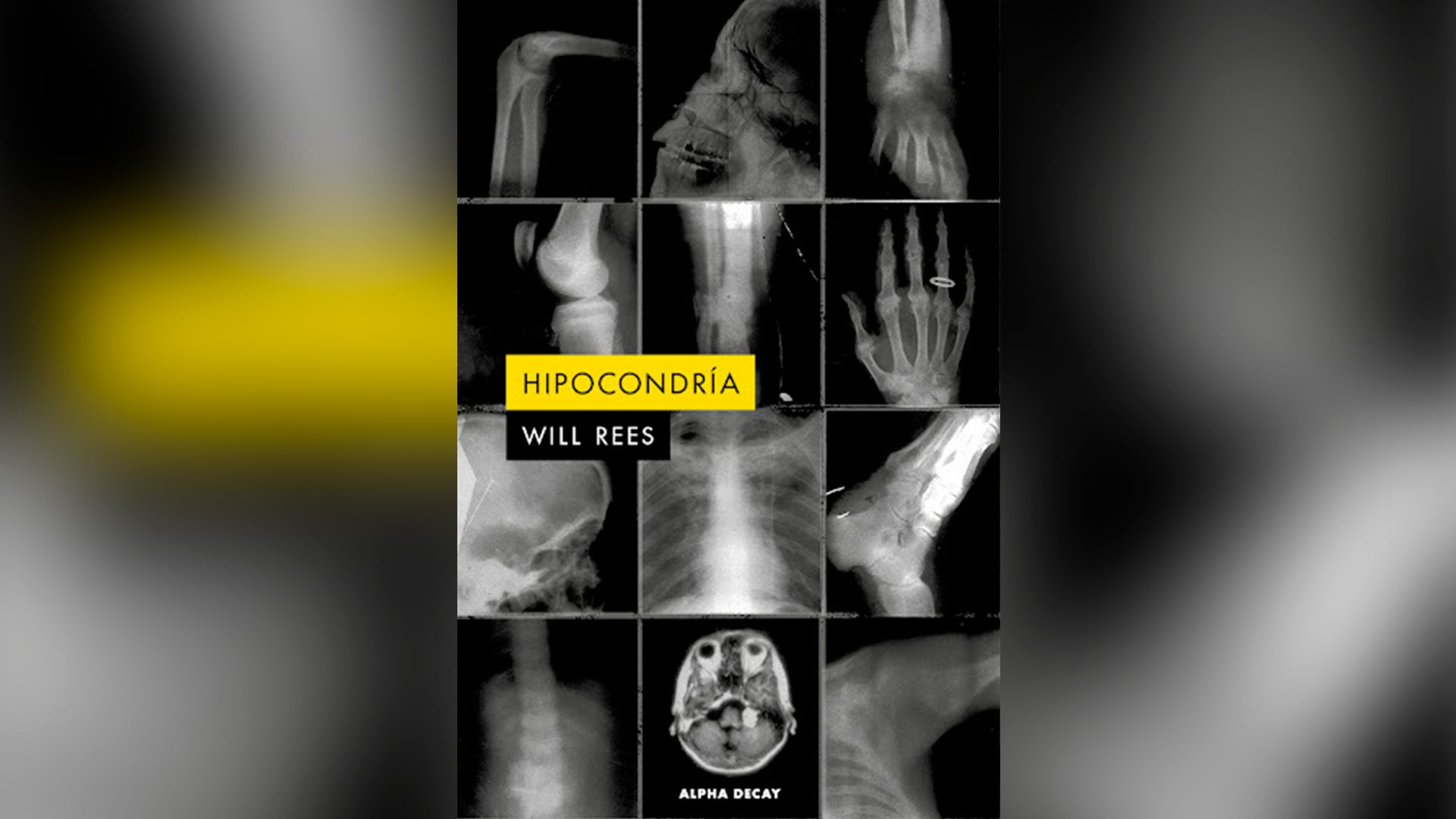 Portada del libro 'Hipocondría', de Will Rees, editado por Alpha Decay