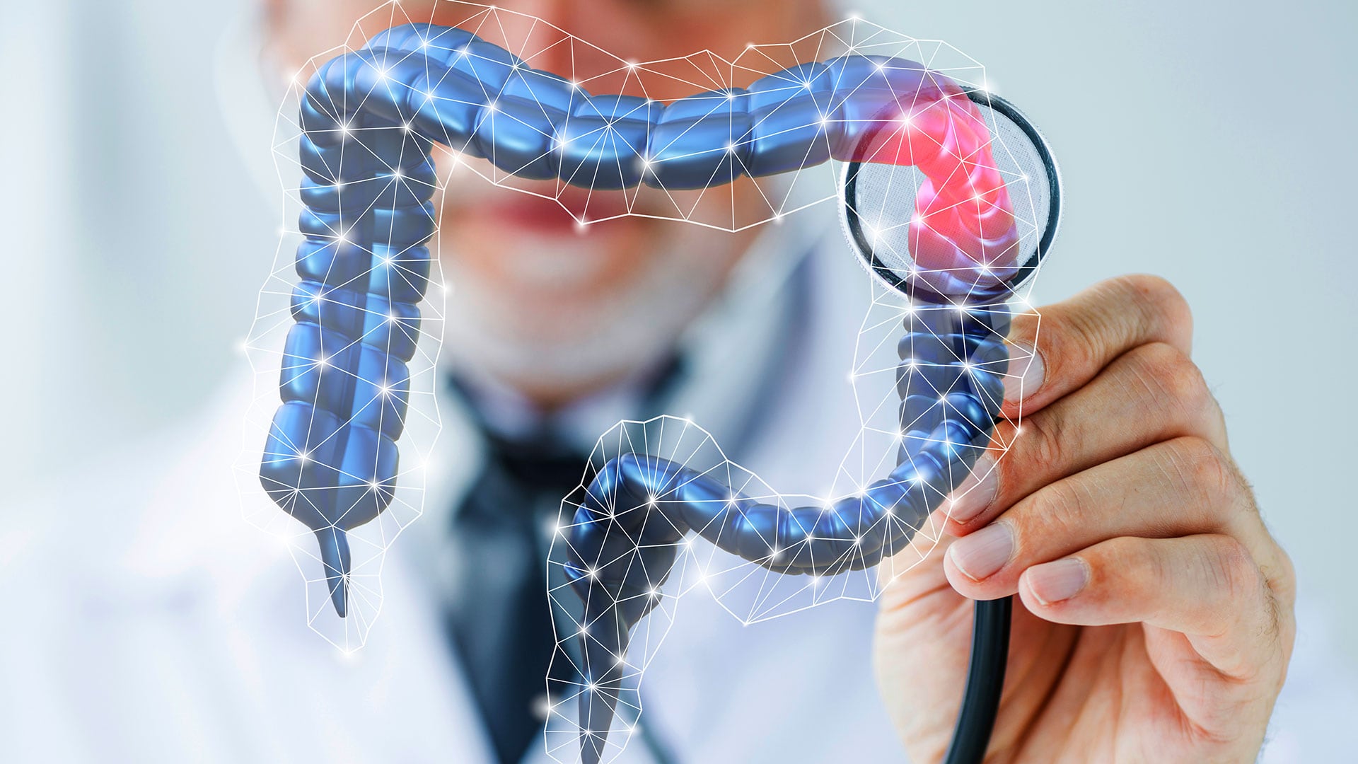 Solo el 5% de los casos de cáncer de colon tiene origen hereditario confirmado, según la Sociedad Americana del Cáncer (Freepik)